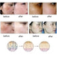 Scar & Stretch Mark Removal Essence Oil – Natural Acne Spot Treatment & Skin Repair Serum