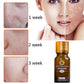 Scar & Stretch Mark Removal Essence Oil – Natural Acne Spot Treatment & Skin Repair Serum