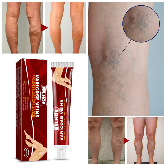 Earthworm Leg Vein Massage Cream For Relieving Leg Vascular Protrusion And Leg Swelling