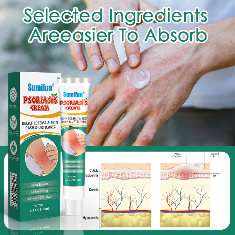 Psoriasis Cream Relieve Dermatitis Eczema YI Bacteria Anti-Itching Cream