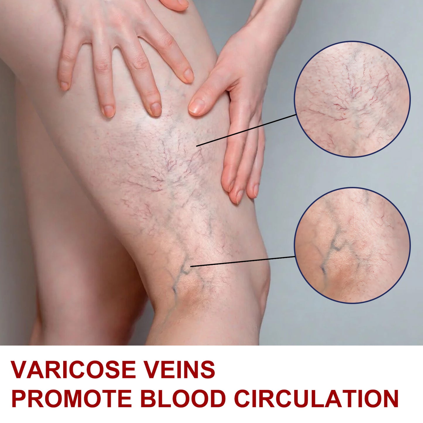 Earthworm Leg Vein Massage Cream For Relieving Leg Vascular Protrusion And Leg Swelling